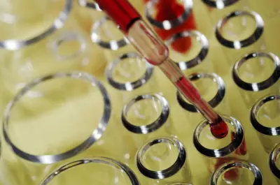 دلیل مدفوع خونی, خون در مدفوع