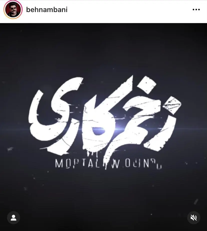 آهنگ «زخم کاری» منتشر شد