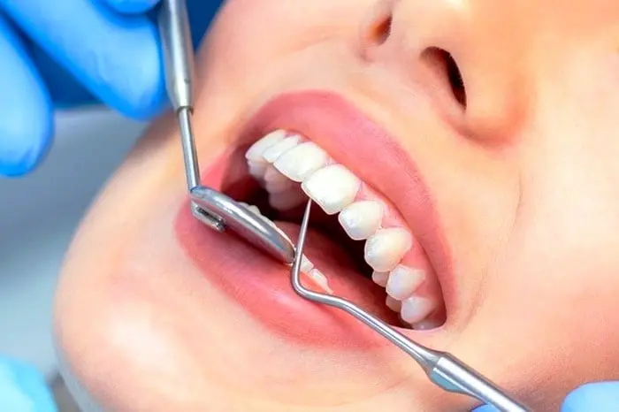 چای سبز برای مشکلات دهان و دندان مشکلات دهان و دندان