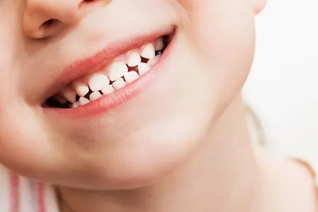 پالپکتومی دندان کودکان, پالپکتومی دندان شیری, روش انجام پالپکتومی