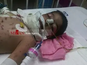 حمله گرگ به کودک 3 ساله