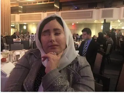 قربانی اسیدپاشی مهمان ضیافت شام رییس‌جمهور