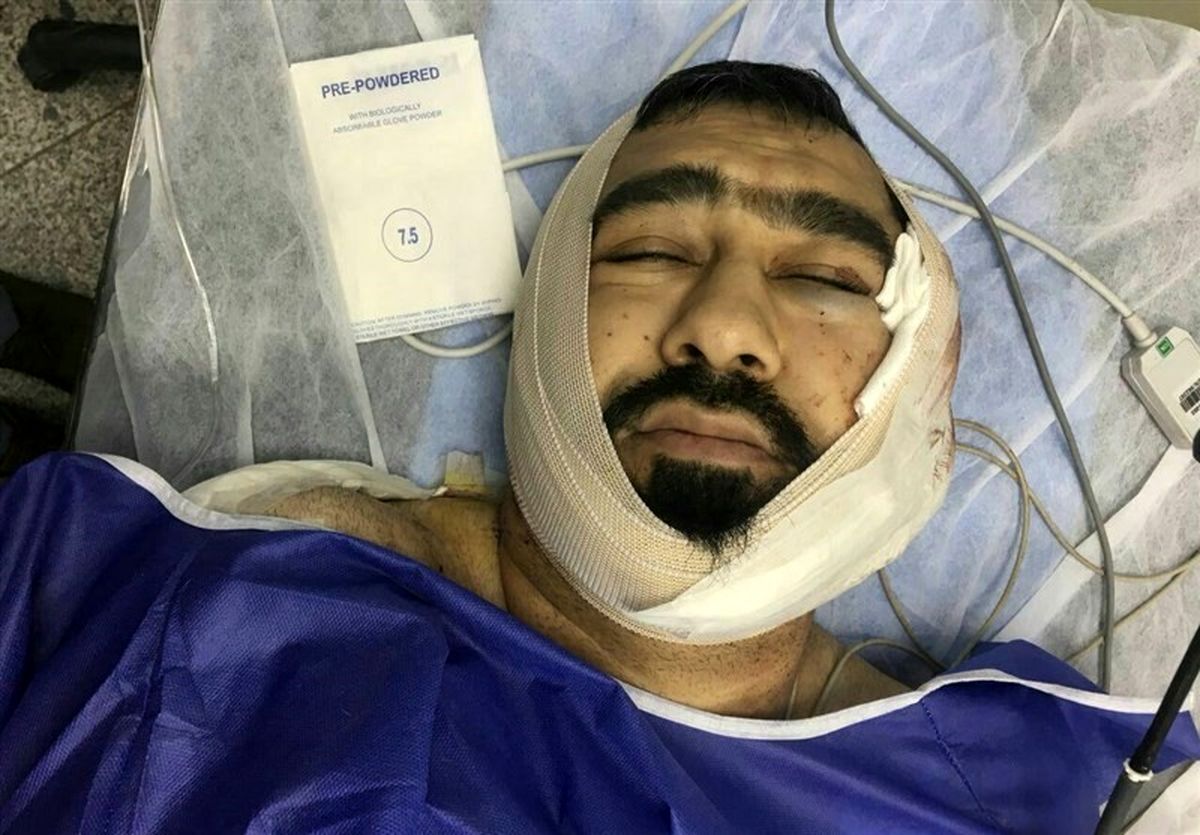 آخرین وضعیت &quot;طلبه‌ تهرانی&quot; که با ضربات قمه یک اوباش مجروح شد