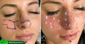 تتو چراغی !