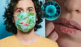 تغییرات عجیب لب‌ها بر اثر ابتلا به ویروس کرونا / عکس