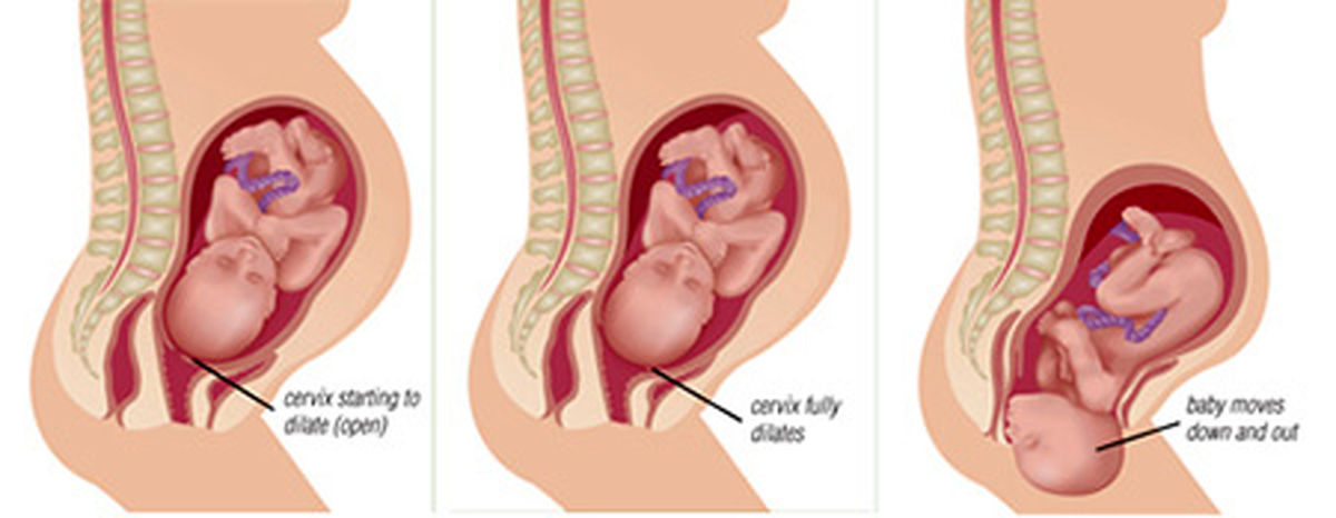 مراحل زایمان طبیعی (جهت آشنایی زنان باردار)