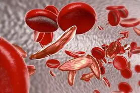 علل و درمان کم خونی/ آهن خون را چگونه تنظیم کنیم؟