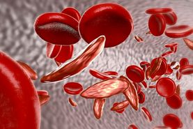 علل و درمان کم خونی/ آهن خون را چگونه تنظیم کنیم؟
