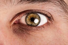 دلایل تیره شدن چشم؛ از خستگی تا واکنش‌های آلرژیک