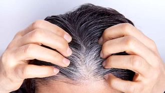 نسخه‌های طبیعی برای درمان ریزش و سفیدی مو