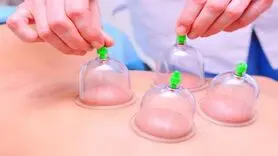 بادکش درمانی؛ اصول و فواید