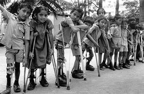 علائم و پیشگیری از بیماری فلج اطفال