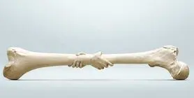 همه چیز درباره پوکی استخوان/ با این غذاها پوکی استخوان را برطرف کنید