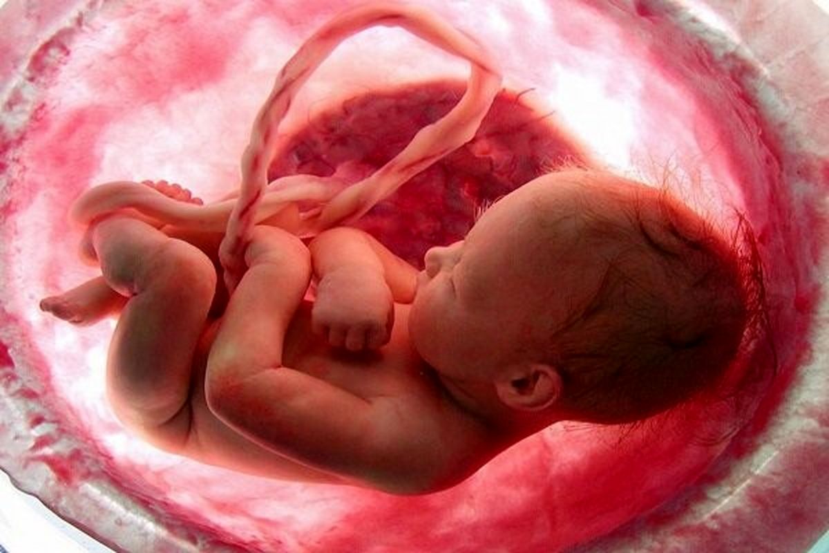 ۷۰ درصد از سقط‌های مکرر خود به خودی جنین درمان‌پذیر است
