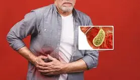 طب سنتی چه راهکاری برای "سنگ کیسه صفرا" و تسکین درد آن دارد؟