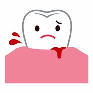علت خونریزی لثه + قطع فوری خونریزی دندان