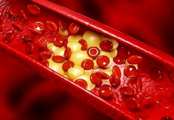 روش‌های درمان چربی خون + فیلم