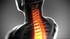 علائم و راه های درمان دیسک گردن + فیلم