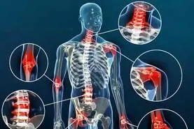 آرتروز چیست؟ | علائم، علل، درمان و روش‌های پیشگیری